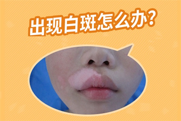 铜陵白癜风的病发因素有哪