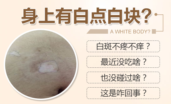 合肥华研白癜风医院